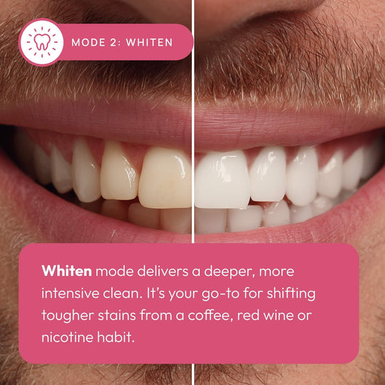 Sonic Electric Toothbrush